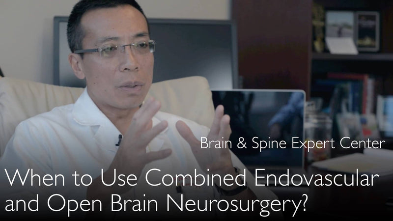 Gecombineerde endovasculaire en open hersenchirurgie. Voorbeeld. 2