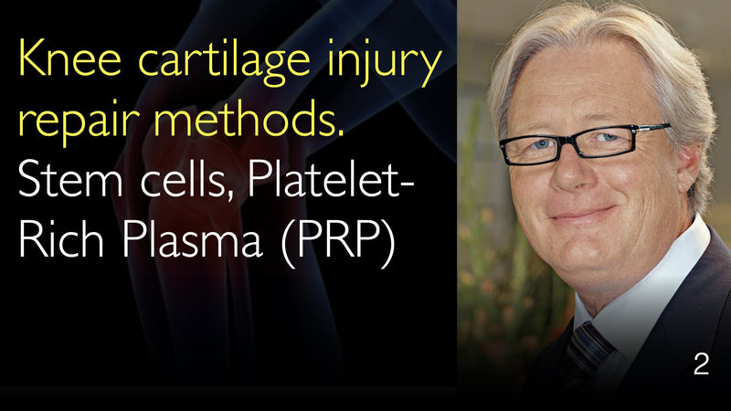Herstelmethoden voor kniekraakbeenletsel. Stamcellen en bloedplaatjesrijk plasma (PRP)