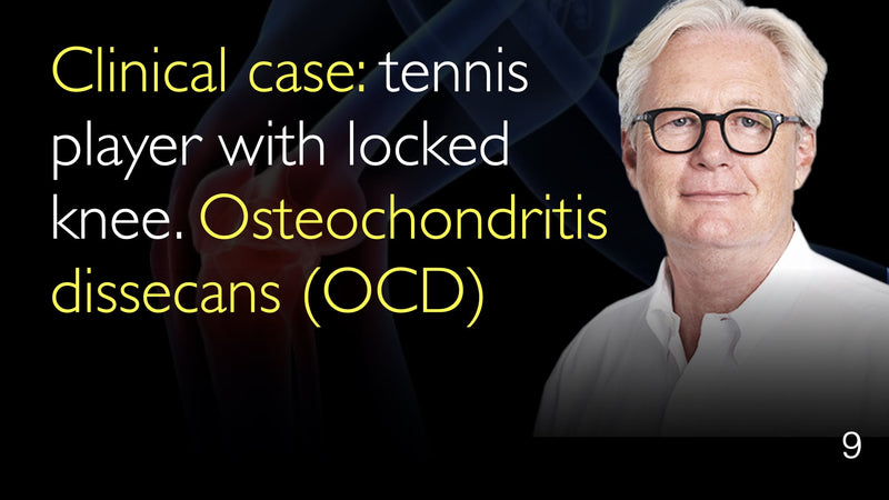 Klinisch geval. Tennisspeler met gesloten knie. Osteochondritis dissecans (OCS). 9