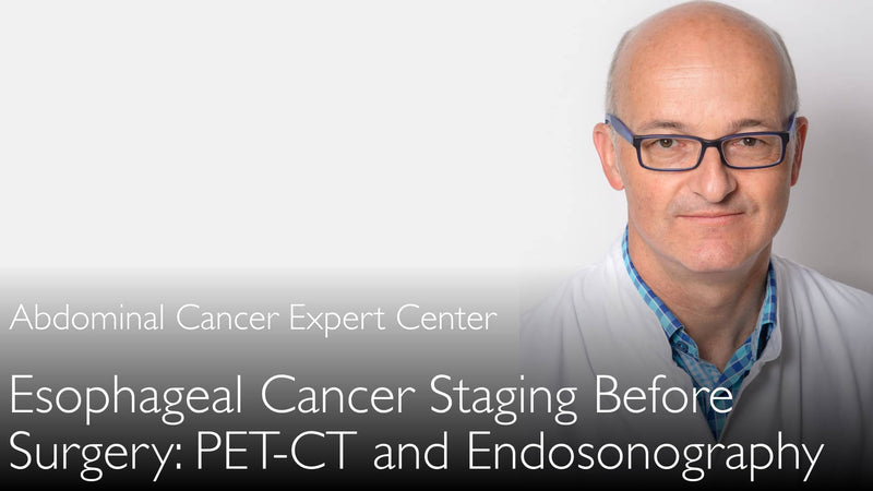 Stadiëring van slokdarmkanker vóór de operatie. PET-CT en endosonografie. 8