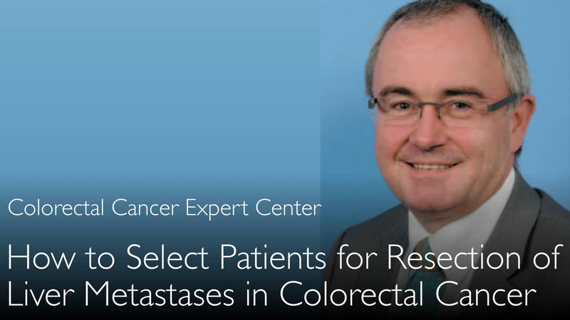 Hoe patiënten selecteren voor chirurgische resectie van levermetastasen? Stadium 4 colorectale kanker. 2